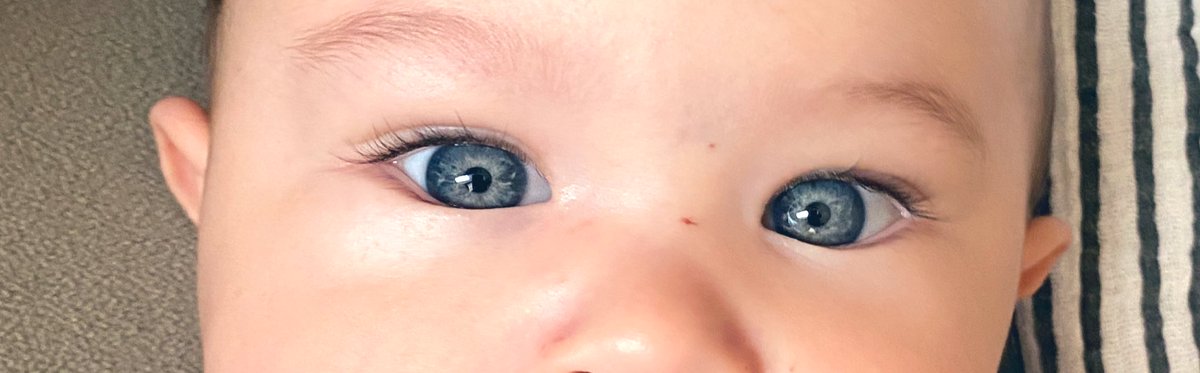 Tataaxer's tweet photo. Meu filho nasceu assim, será que é um sinal? #Bolsonaro22 #damaresalves #michellebolsonaro #gv https://t.co/U0GBI9Rd4q