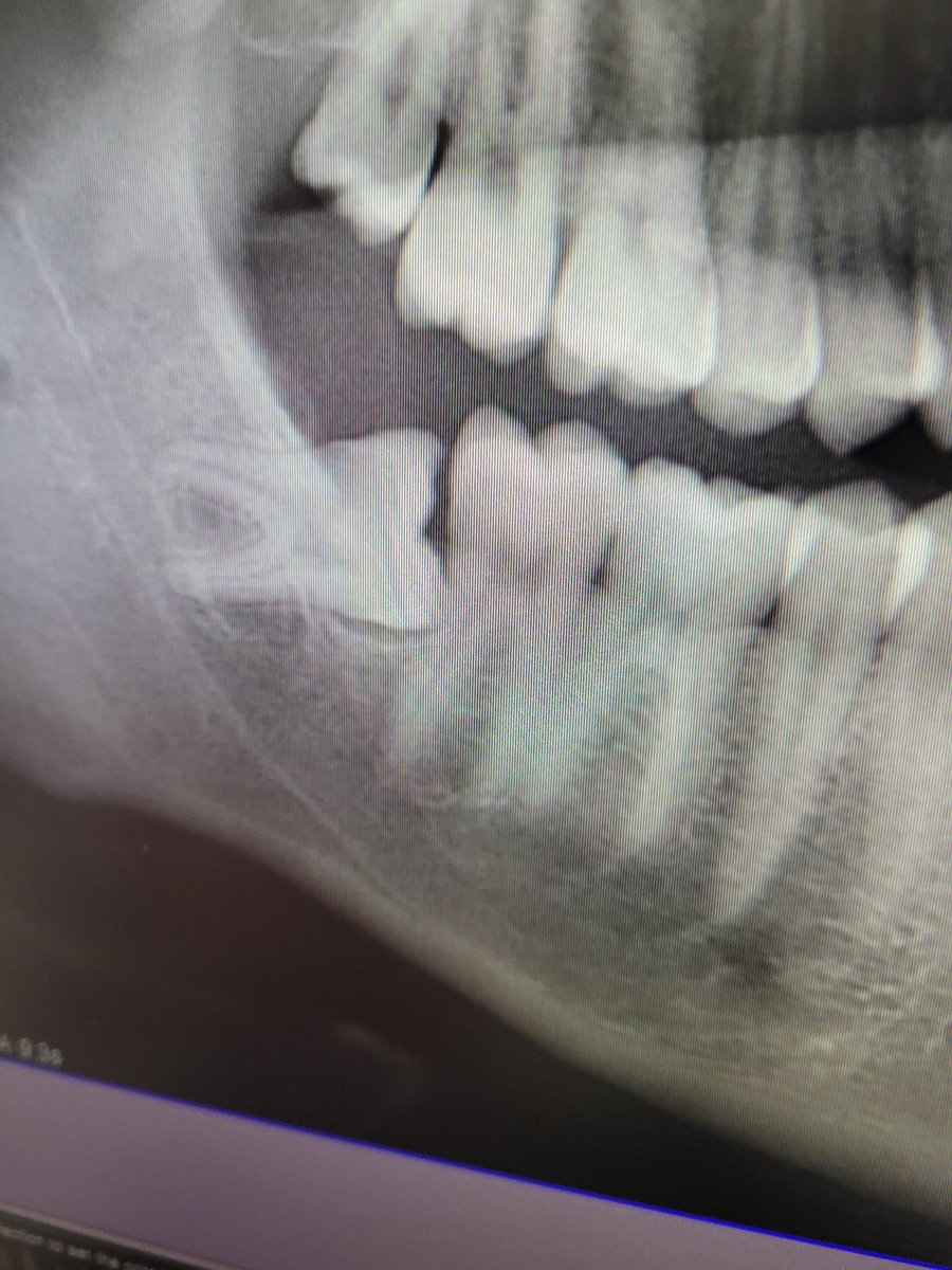 Það er eitthvað skakkt við þetta 🤔