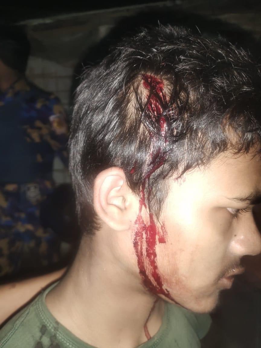 We are repeatedly hearing that killings of civilian in camps and many people claims that ARSA is responsible. Bear in mind that you will be held accountable for every single crime against civilians. Simply tweeting statement of denial is enough.Impunity must end very soon.