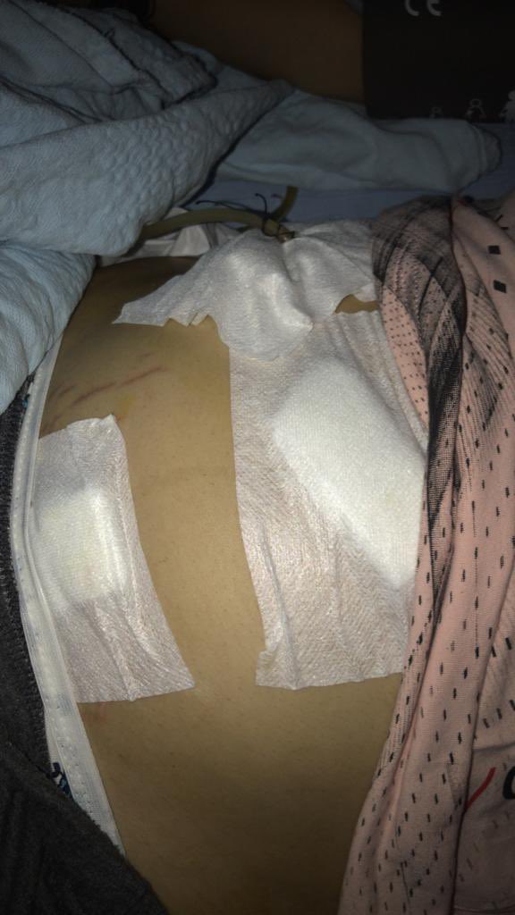 Ben emine yılancı 
17ekim sabahı sancıyla uyandım 20:00 saatlerinde hastaneye gittim acilde röntgen çekildi lağma verilip yurda gönderildim lağmayı verirken 2erkek ve 1 kadın (hemşire +doktor )benimle dalga geçti 
aksi bir şey olursa doktor hastaneye gelmemi söyledi +++++