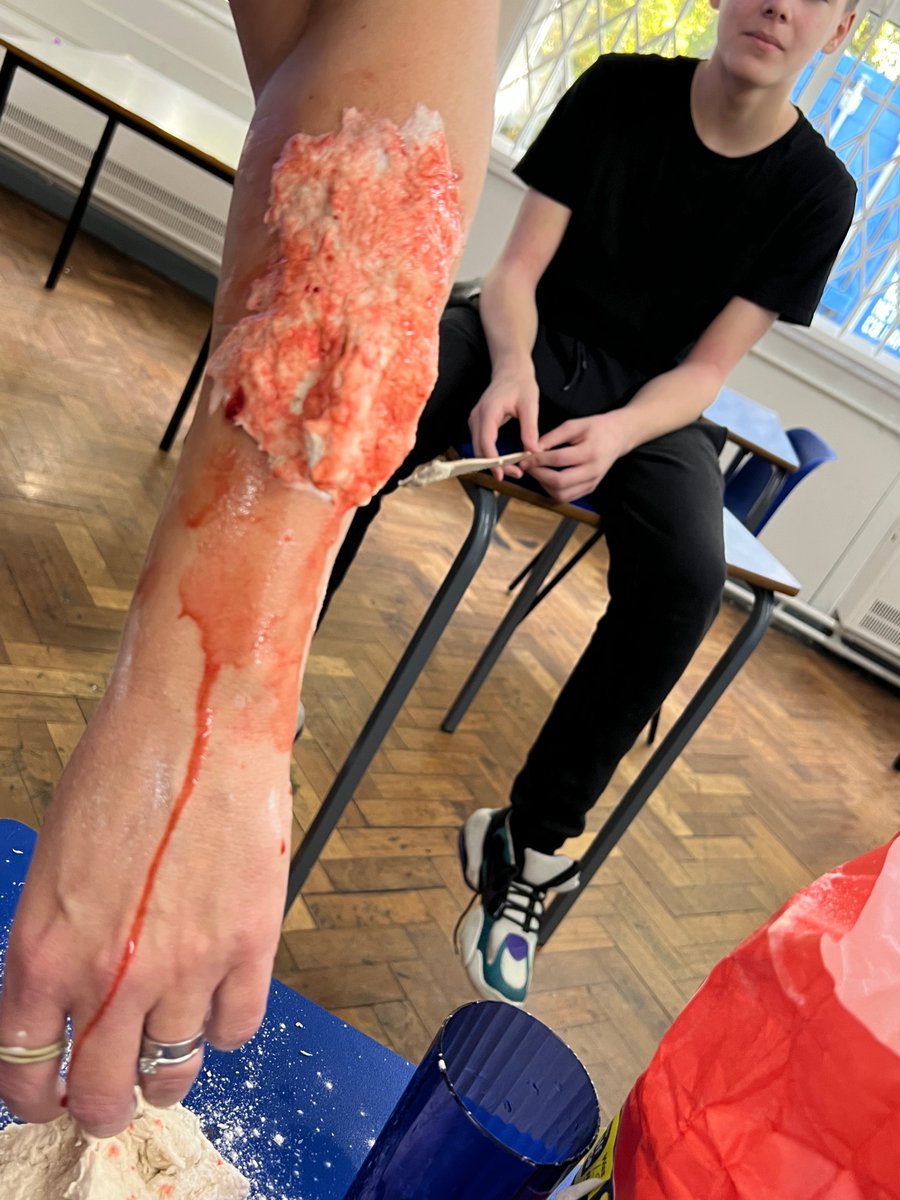 COBS_Firsbrook's tweet photo. Year 10 learning the life skills of First Aid. #fakewounds https://t.co/ImvEspuV8s