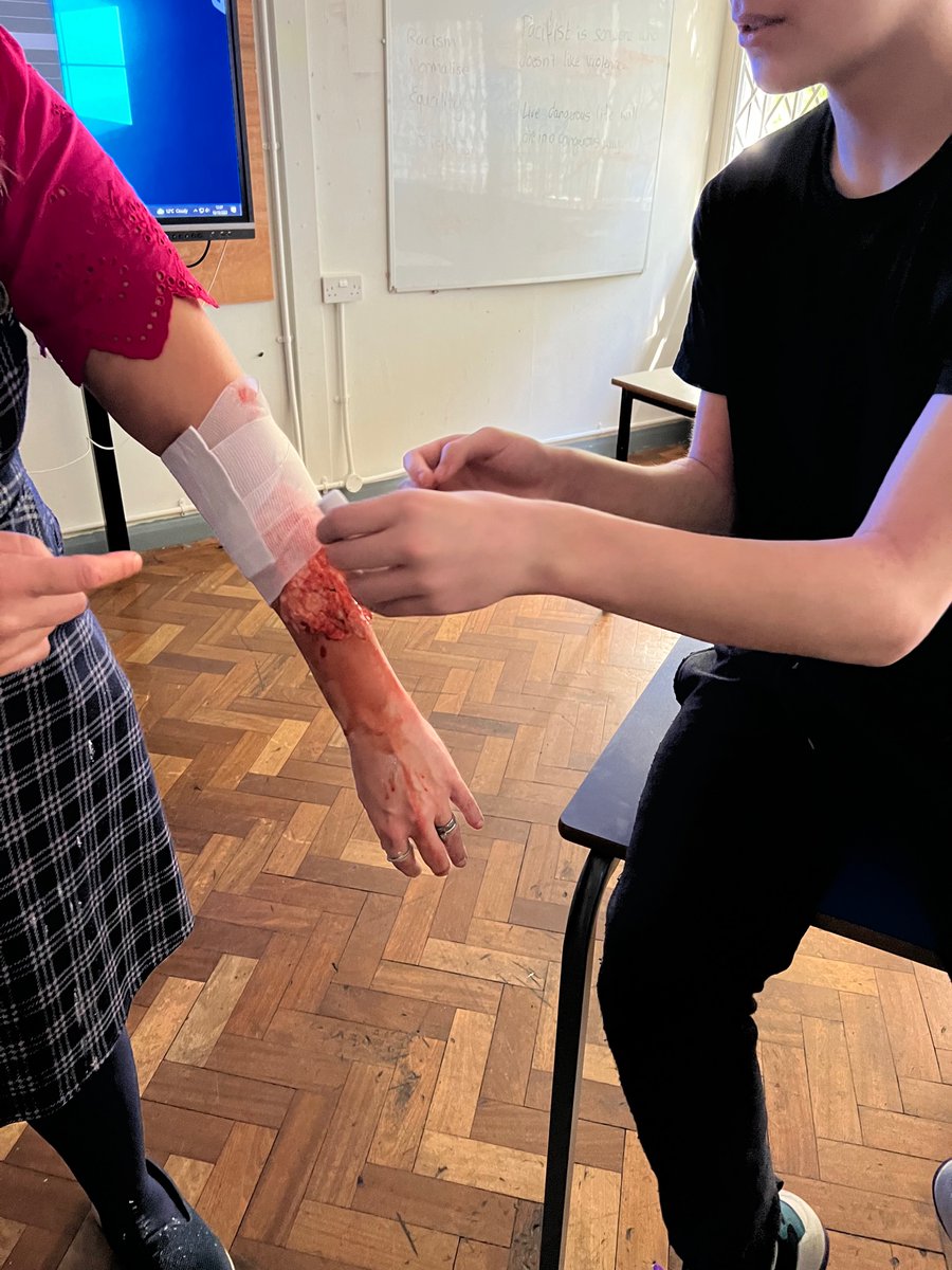 COBS_Firsbrook's tweet photo. Year 10 learning the life skills of First Aid. #fakewounds https://t.co/ImvEspuV8s