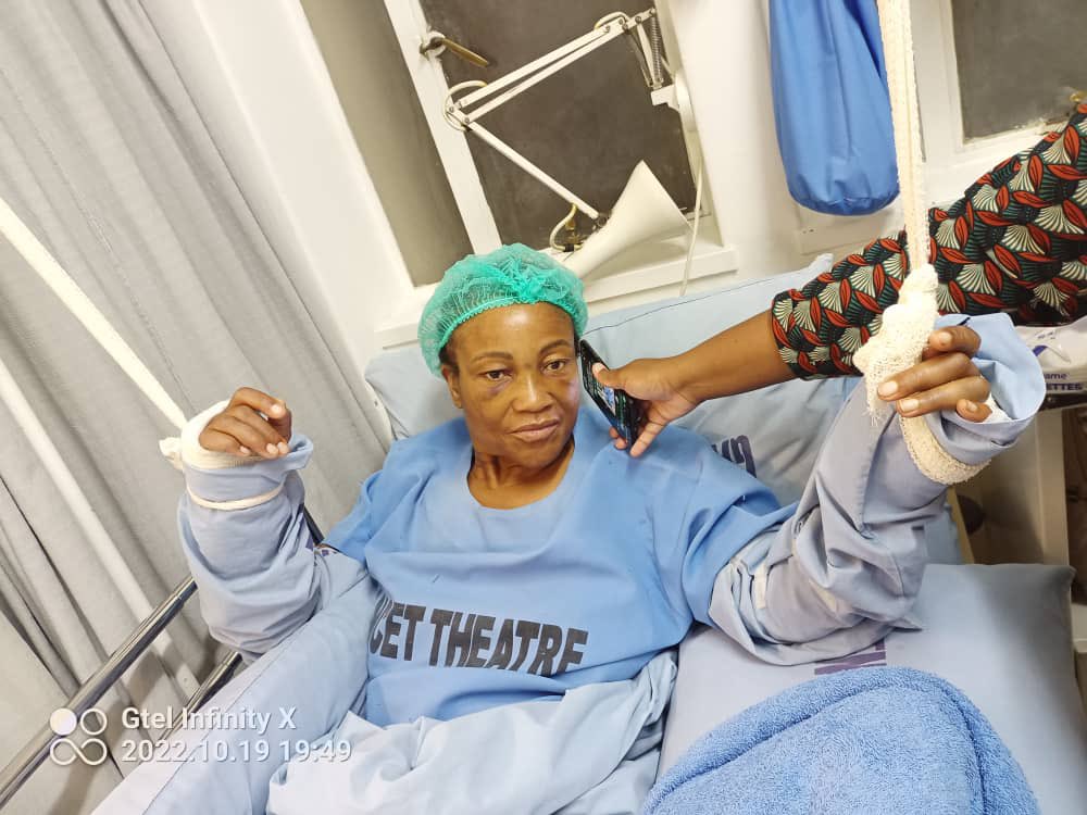 This is what Zanu PF does to Honourable Members of #Parliament in #Zimbabwe. Hon <a href="/ToffaJasmine/">Jasmine Toffa nee' Koks (Hon)</a> was campaigning peacefully for <a href="/CCCZimbabwe/">Citizens' Coalition for Change</a> and was seriously assaulted by 4 Zanu PF thugs who broke both her hands and bruised her using poles &amp; karate kicks. <a href="/ZECzim/">Zimbabwe Electoral Commission</a> <a href="/PoliceZimbabwe/">Zimbabwe Republic Police</a>