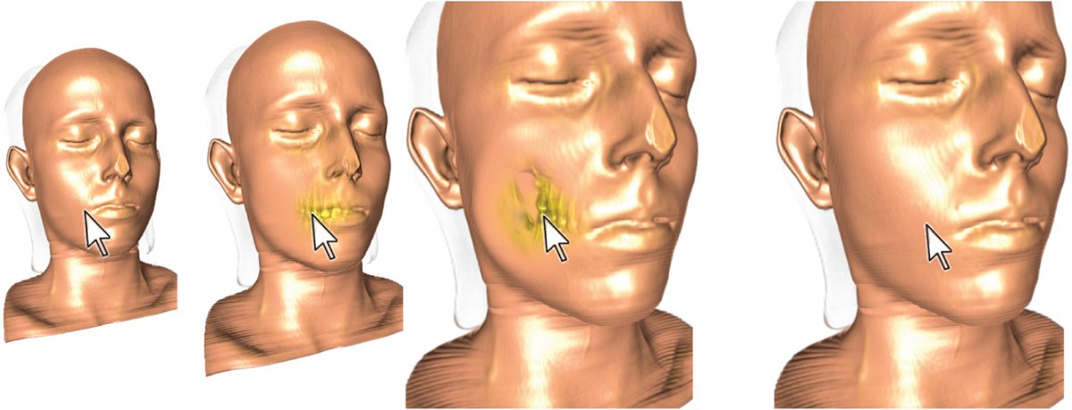 CagJournal's tweet photo. A survey of medical animations

See more: https://t.co/w0kQyIN27A 
Authors: Preim, Meuschke
#CagJournal #ComputerGraphics #survey #medical #medicalanimation #video #visualanalysis #biomedical #biomedicalsimulation #biomedicaldata #siggraph #sigchi #eurographics https://t.co/GUmrD5SK0j