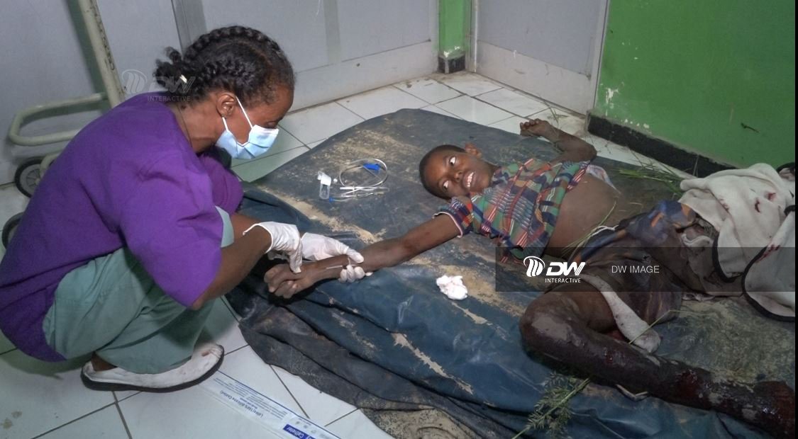 AduAdu810's tweet photo. The fascist 🇪🇹 &amp; 🇪🇷 forces are bombing civilians in North West Tigray mainly in the town of #Shire. following the horrofic attack hundreds of civilians are dying &amp; Ten thousands civilians are displacing from their home town. #ShireUnderAttack #TigrayGenoicde @POTUS #UNSC act now. https://t.co/Qng6I7WED1