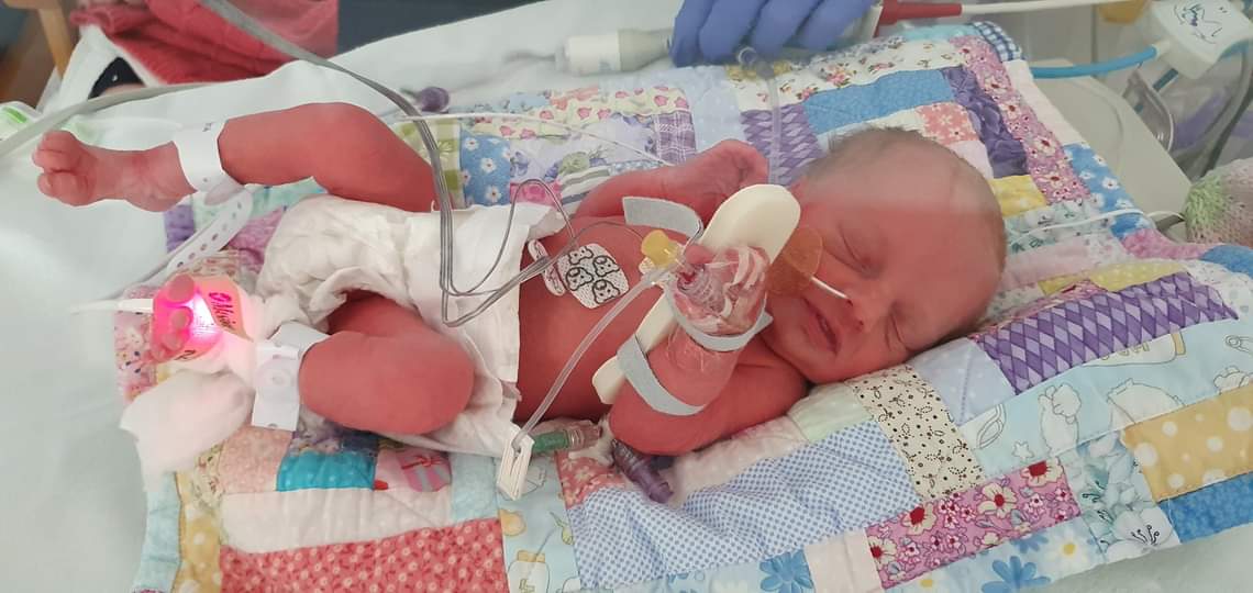 LouiseFBarth's tweet photo. Delighted to become Granny to our beautiful Paige, fair few weeks sooner than we expected but she certainly made an entrance and I am certain she will continue to be strong, sassy and powerful
So proud of Abi Dobson and Andy Dobson and congratulations on becoming parents ❤️❤️ xx https://t.co/OyP9GeQZ3l