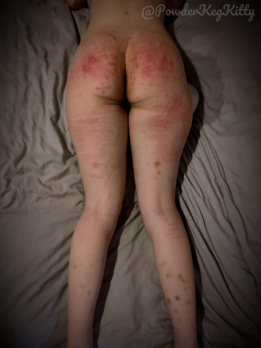 PowderKegKitty's tweet photo. Definitely a fun day off making these marks #nsfw #onlyfans #nsfwtwt #fansly #kinky #BDSM https://t.co/XGt1LtsWNY