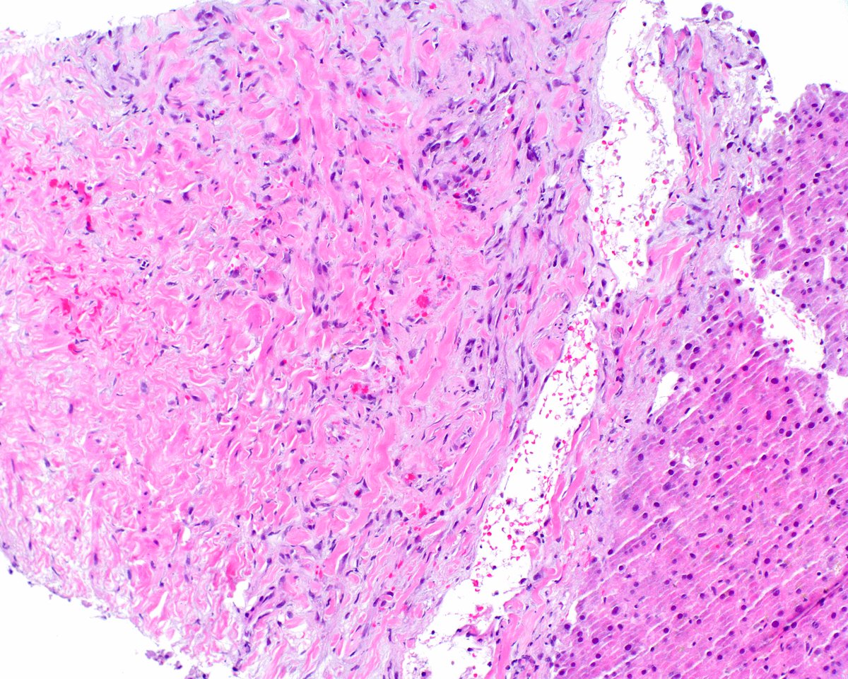 Elizabeth Montgomery, MD tweet media