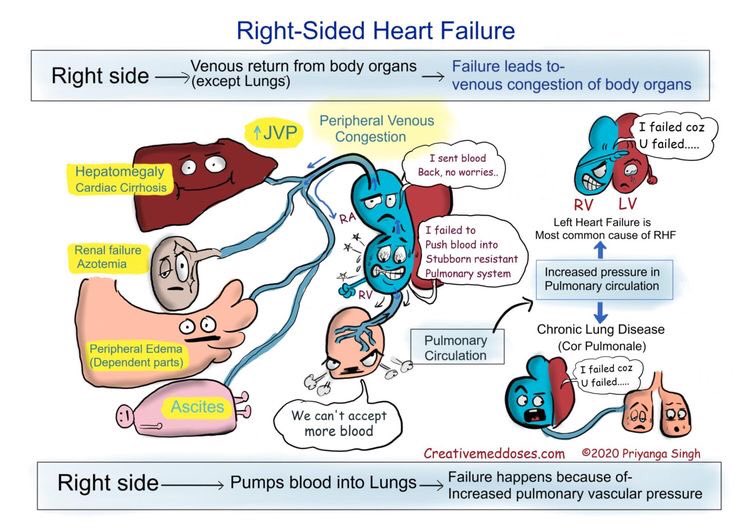 MedicalAdv's tweet image. Heart Failure

#MedEd2022 #MedTwitter #ScienceTwitter #AcademicTwitter #SciComm #CardioTwitter #CardioEd #CardiovascularDisease #HeartFailure 

H/t: @Medical_MD1