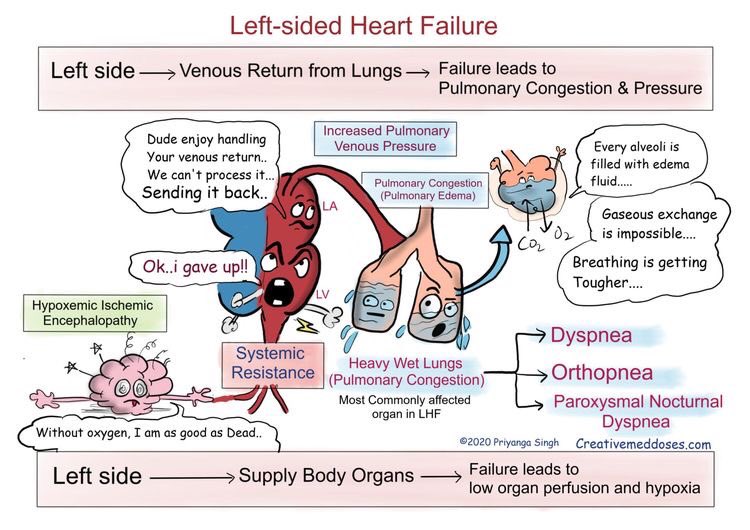 MedicalAdv's tweet image. Heart Failure

#MedEd2022 #MedTwitter #ScienceTwitter #AcademicTwitter #SciComm #CardioTwitter #CardioEd #CardiovascularDisease #HeartFailure 

H/t: @Medical_MD1