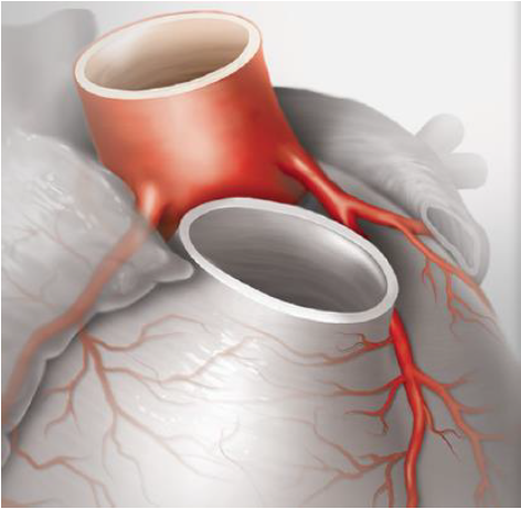 TCHheartcenter's tweet photo. Don't miss the upcoming 5th symposium on Coronary Artery Anomalies from December 1-2, 2022 in Houston! Both in-person and virtual options are available. More information and sign-up can be found at https://t.co/CBlpLk0KOU. #CHD #ACHD #AAOCA @silvana_molossi https://t.co/xbOQLkG3Jh
