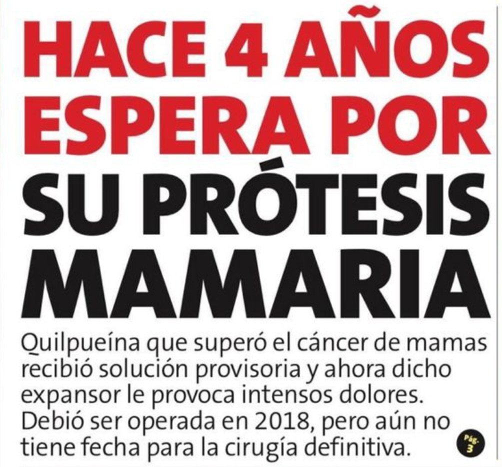 Es difícil superar un cáncer de mamas, más difícil es superar el trauma y las secuelas que te deja la enfermedad, si el estado no apoya a estas mujeres, nunca podrán superar el trauma que deja ...
#BloqueaLaDerecha 
#DiaMundialDelCancerDeMama