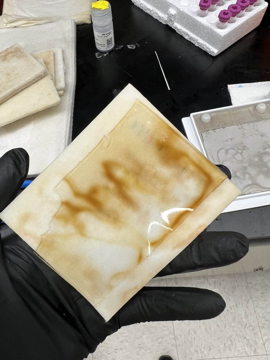 TheHematoPoet's tweet image. Hey science Twitter, anyone good with western blots who can tell me what went wrong here? This is the gel post transfer… I promise I didn’t accidentally switch my coffee and the transfer buffer 😭