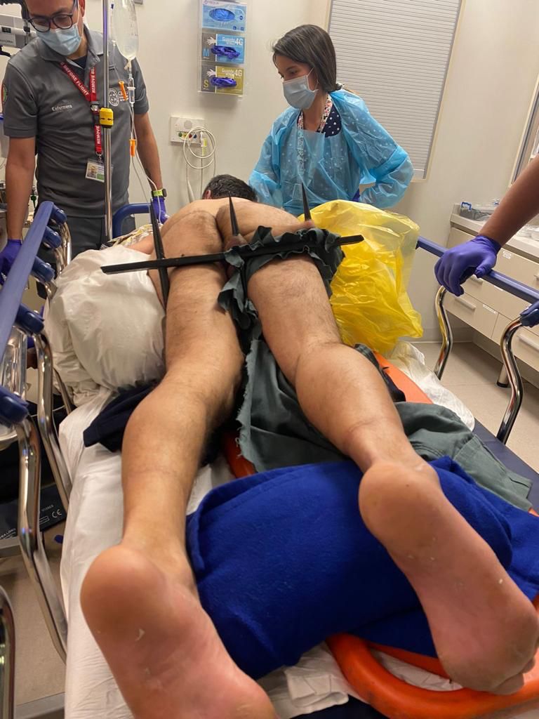 Francis25830521's tweet photo. Ustedes saben que en el fondo no soy malo, pero disfruto estas noticias, y como no soy egoista, las comparto con ustedes. Este delincuente quedó colgado de un testículo mientras iba escapando, el muy sin verguenza.

Esperemos que no deje crias 😂

#ChileNoCaerá https://t.co/2gQl1HCBpl