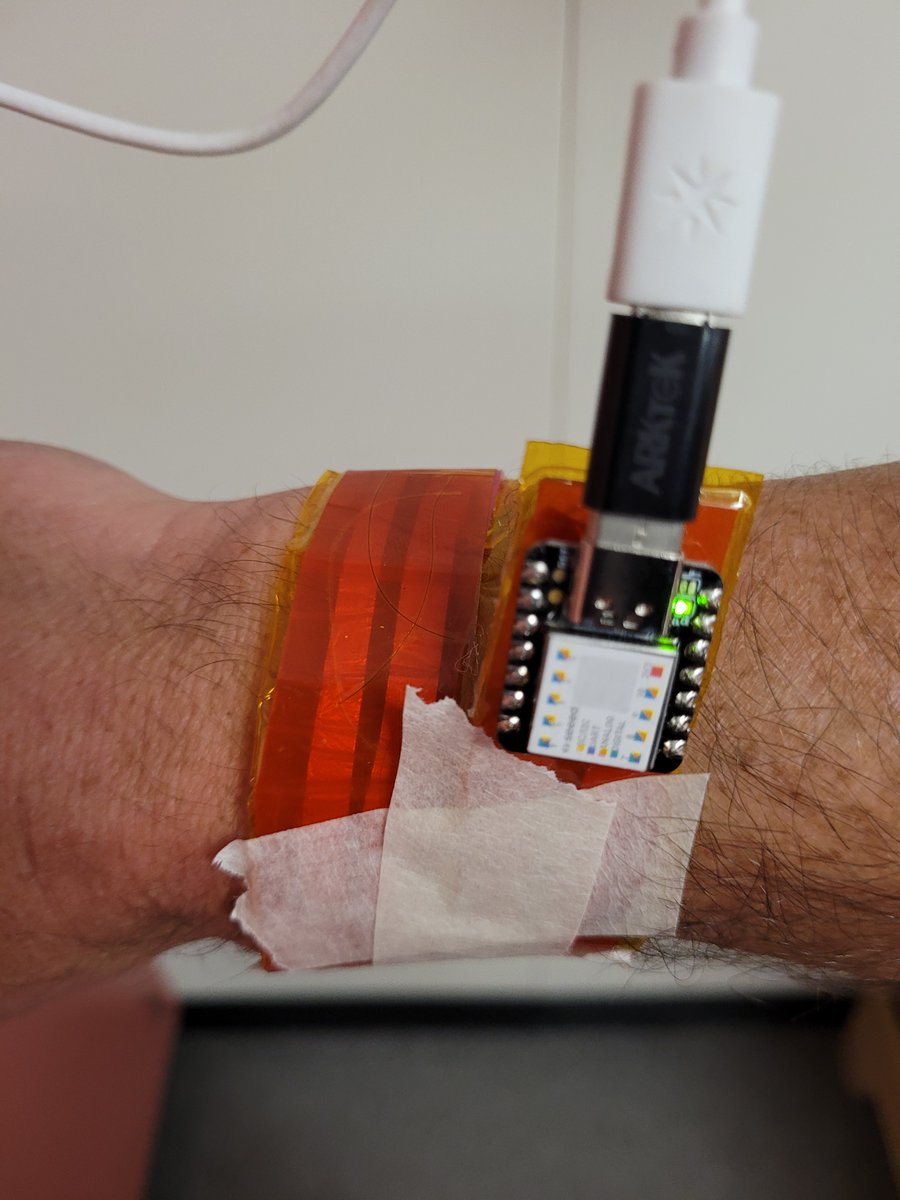 rocksetta's tweet photo. I have been waiting for years for an @arduino  #bioSensor #SweatSensor for Sodium and Potassium. Wondering why they are not available so I made a #XIAO #SweatDuino, which is really unreliable. 

Any #MaterialsScientists, #bioMedicalEngineers want to chat about the issues? https://t.co/CoT7do3gB6