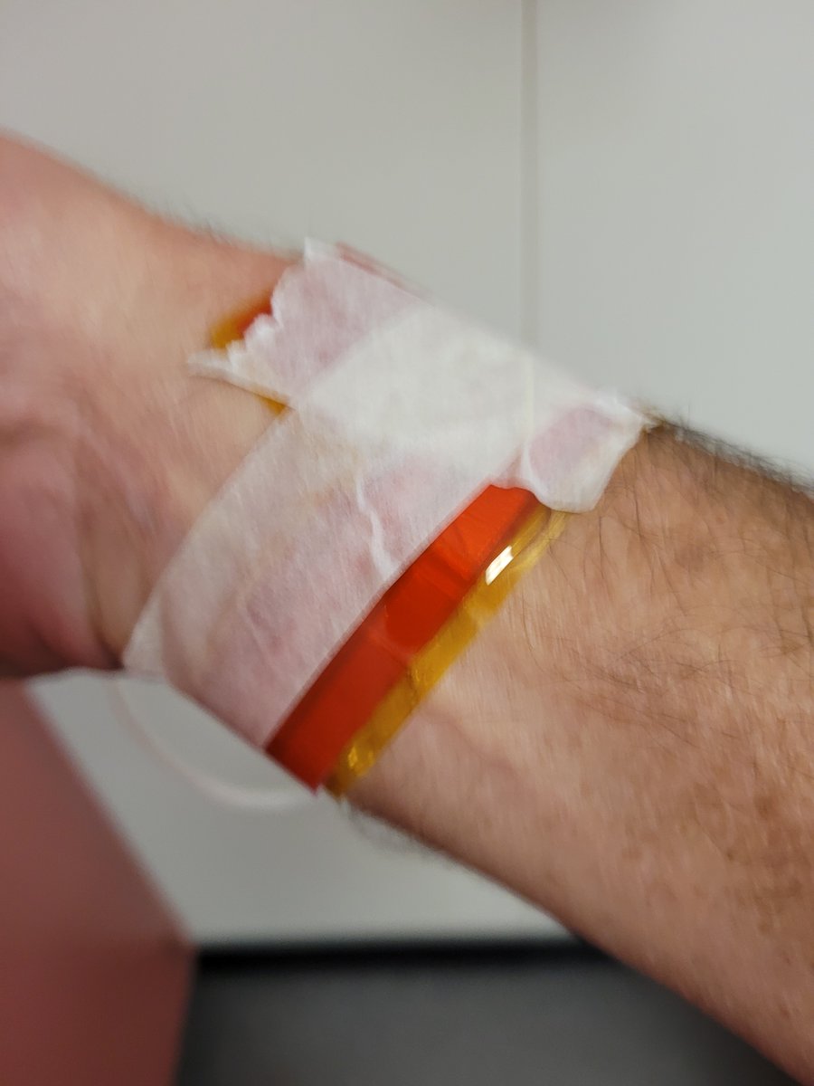 rocksetta's tweet photo. I have been waiting for years for an @arduino  #bioSensor #SweatSensor for Sodium and Potassium. Wondering why they are not available so I made a #XIAO #SweatDuino, which is really unreliable. 

Any #MaterialsScientists, #bioMedicalEngineers want to chat about the issues? https://t.co/CoT7do3gB6