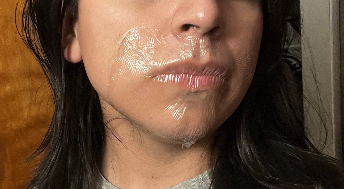 LedesmaBound's tweet image. i’m trying that tegaderm again, i think i’m gonna try to do two next time so it covers the rest of my lower face