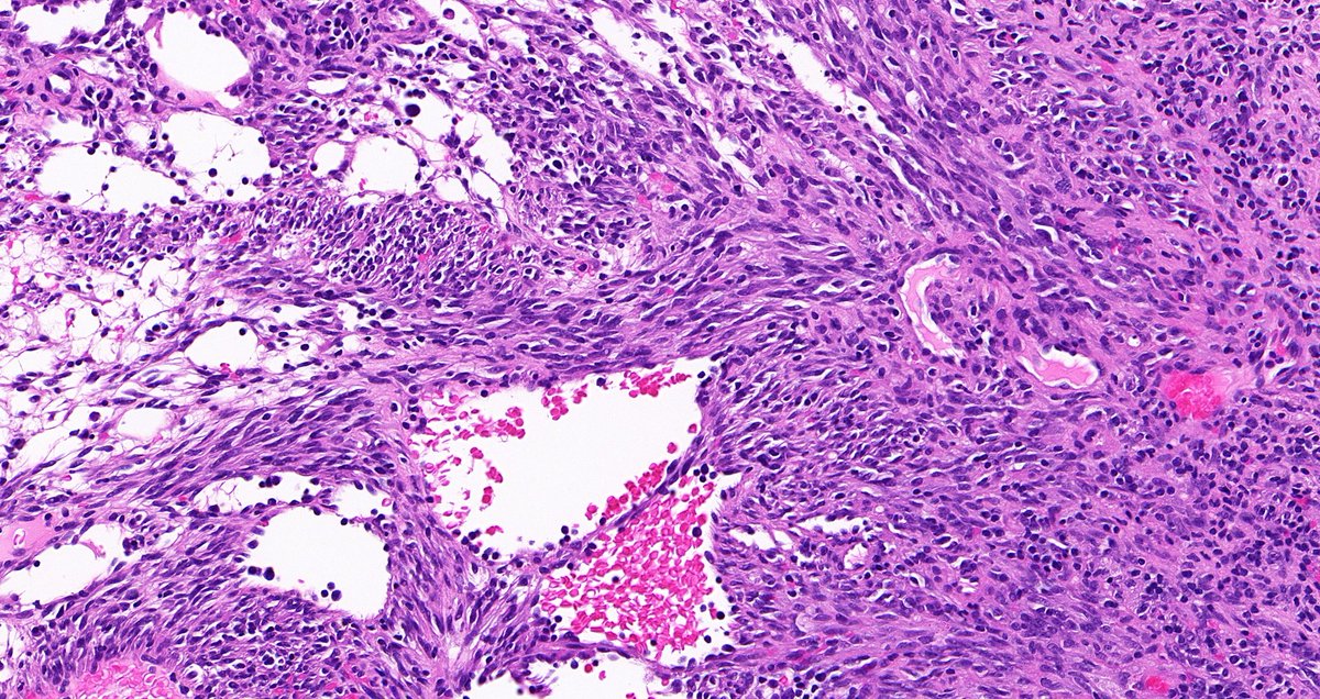 Tristan Rutland MBBS FRCPA IFCAP tweet media