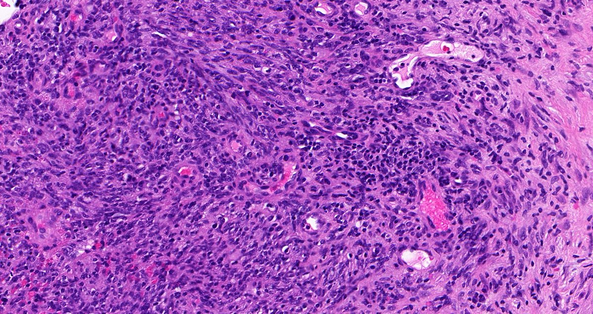 Tristan Rutland MBBS FRCPA IFCAP tweet media