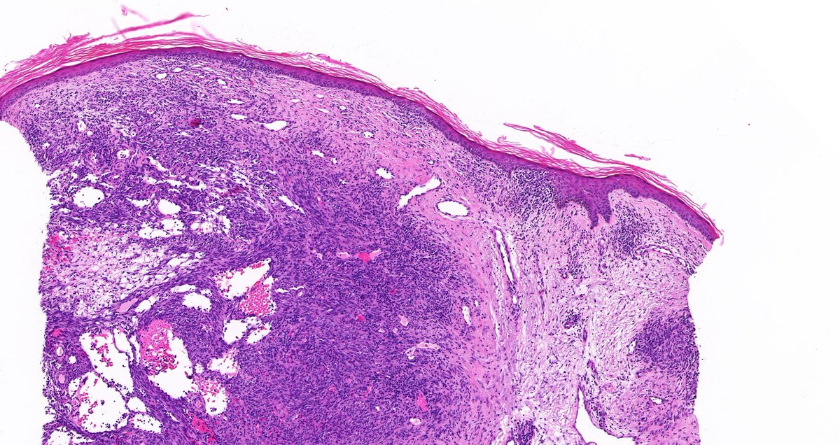 Tristan Rutland MBBS FRCPA IFCAP tweet media