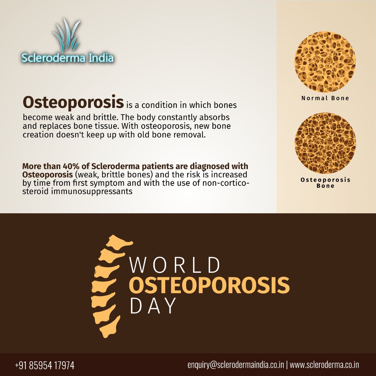 ScleroIndia's tweet photo. #WorldOsteoporosisDay 
More than 40% of scleroderma patients are diagnosed with osteoporosis. 

@IndianRheum @LupusIndia @IndiaSjogren
@IndiaArthritis

#SclerodermaIndia #Scleroderma #Osteoporosis #BoneWeakness #Sclerosis #SystemicSclerosis #Healthybones #HealthDay #Healthy https://t.co/nHwiSXXnPQ