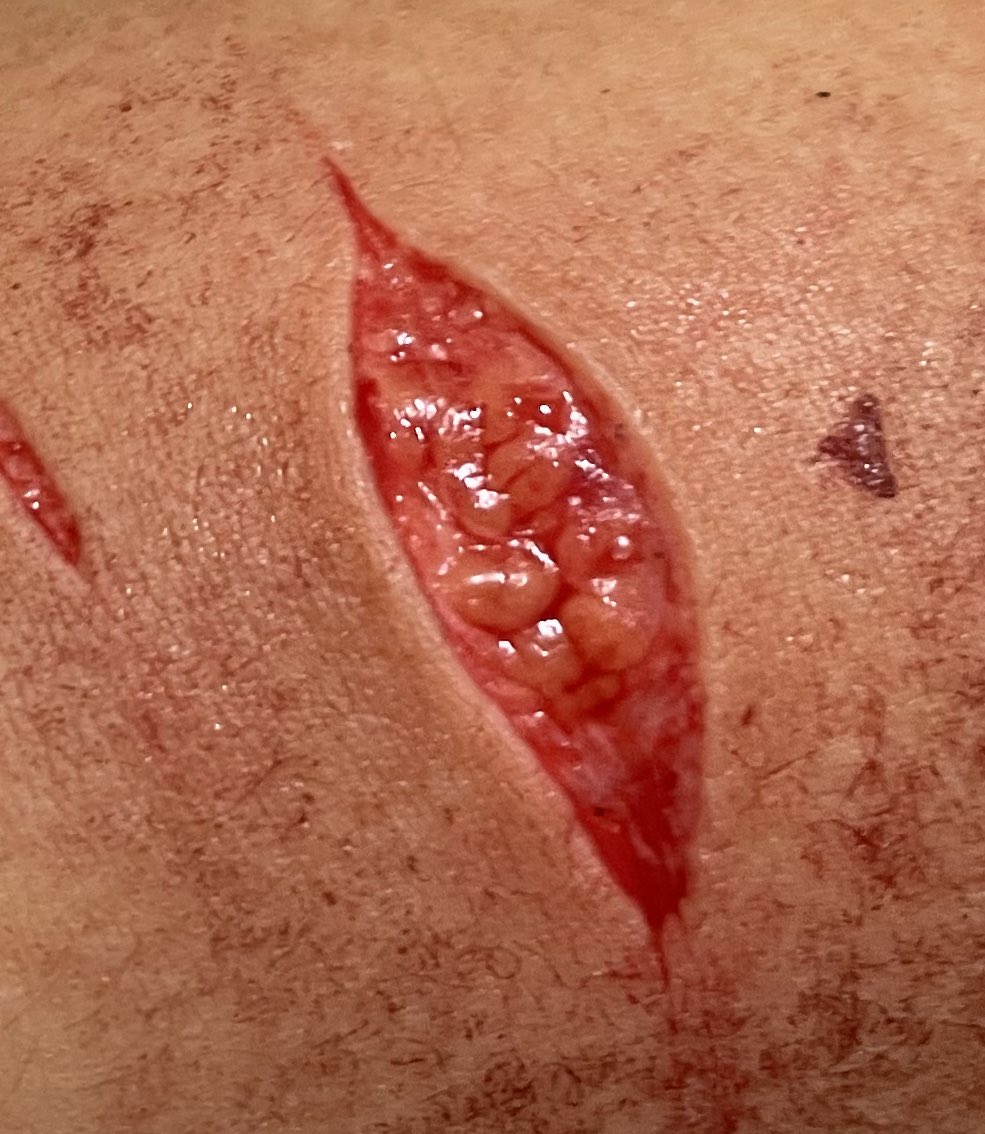 bludluuv's tweet photo. parece una vagina 

988twt https://t.co/HOneiizVuj