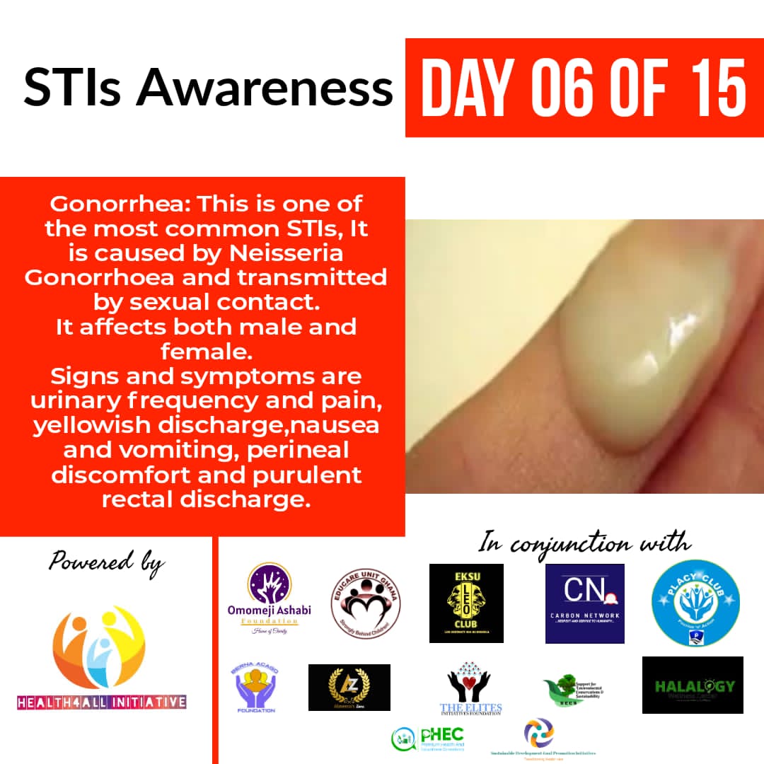 AlmeeraZone's tweet photo. *STIs Awareness* 

 _Day 06 Of 15_ 

Gonorrhea: This is one of the most common STIs, It is caused by Neisseria Gonorrhoea and transmitted by sexual contact. 
   It affects both male and female. https://t.co/hmpo1Z6fxC