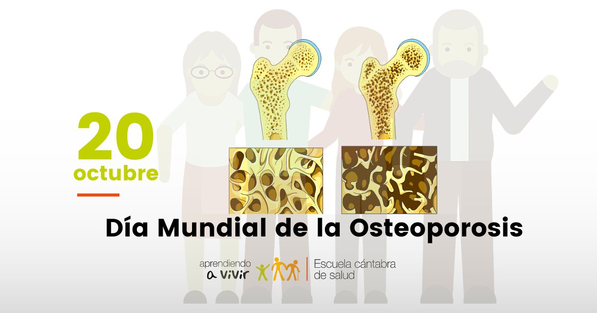 ecsalud's tweet photo. Hoy celebramos el Día Mundial de la Osteoporosis, una enfermedad crónica y progresiva que reduce la densidad y calidad de los huesos, produciendo un mayor riesgo de fracturas. Conoce más en nuestro apartado especial de la web: https://t.co/ivKgeRKyoA https://t.co/CeLQurXyIy