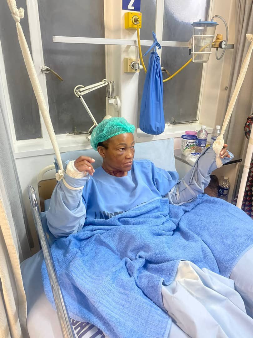 nelsonchamisa's tweet photo. This is MP, Hon Toffa in hospital.She was assaulted by Zpf in Insiza. They broke both her hands.The perpetrators haven’t been arrested and yet innocent citizens #Nyatsime17 have been behind bars for the past 128 days without bail or trial. Zanupf @edmnangagwa STOP THIS VIOLENCE! https://t.co/AJaMIQ0vU4