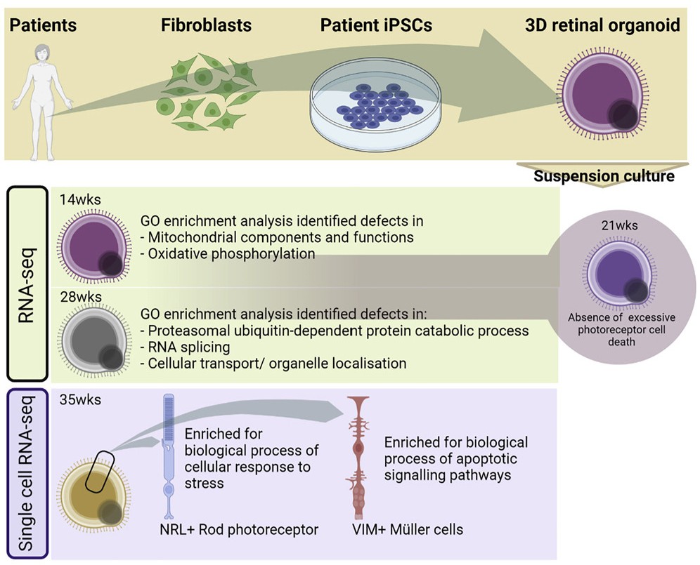 🏅 A one-of-a-kind research! Dr. Jane Sowden and team established the first #RetinalOrganoid disease model for USH1B by coupling #iPSC technology and in vitro retinal differentiation protocols. 👁️ @stemcellreports @UCLchildhealth @GreatOrmondSt 🔓 bit.ly/3CQiX0J