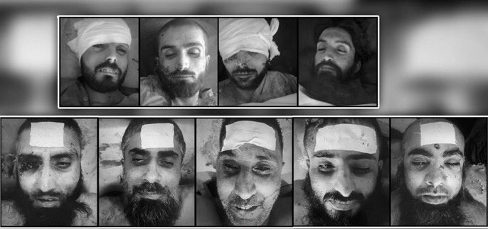 بلوچ نسل کشی کی یہ صورتحال ہے کہ ایک لاش کو دبانے کے لیے ایک اور لاش پھینکی جاتی ہے۔

نشتر ہسپتال کے پانچ سو لاشوں کو دبانے کے لیے لاپتہ بلوچ نوجوانوں کو جعلی مقابلے میں شہید کیا گیا۔

یہ فیصلہ اب ہم پر منحصر ہے کہ لاشوں پر ماتم کریں گے یا اس ظالم و جابر نظام کے خلاف کھڑے ہونگے۔