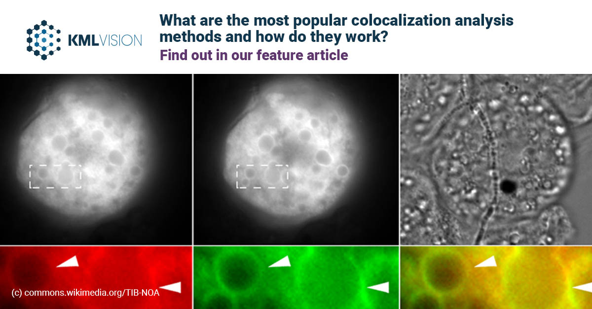 WeAreKolaido's tweet photo. Discover the most in-demand colocalization analysis methods to study interactions and spatial proximity on a cellular and biomolecular level. https://t.co/qMmfcdvRXv
#KMLVision #IKOSA #aimicroscopy #bioimageanalysis #fluorescence #colocalization #proteininteraction https://t.co/fNB3ffg4Hk