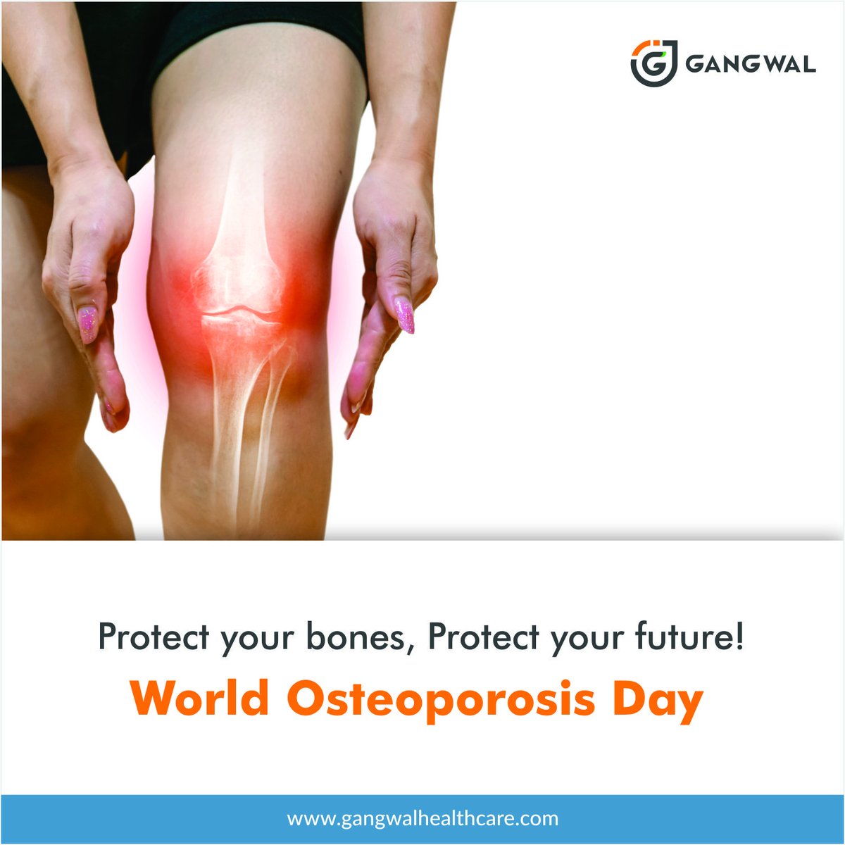 GangwalLtd's tweet photo. Join Gangwal Healthcare in raising awareness for bone health this World Osteoporosis Day 2022.
#bonehealth #worldosteoporosisday #osteoporosis #selfcare #medical #healthcare #health #healthiswealth #workout #bonedensity #boneproblems #healthybones #healthy #weightloss https://t.co/doRIIKs0Qt