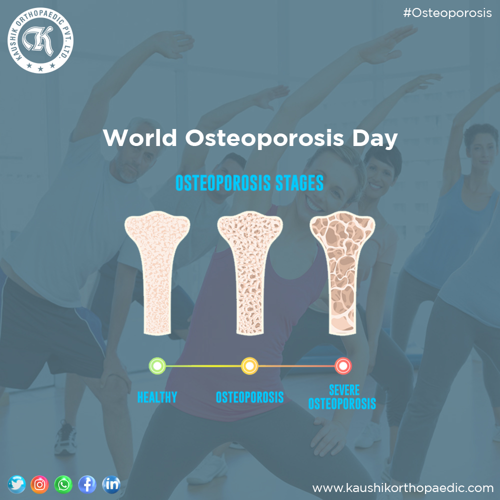 KaushikLtd's tweet photo. Build up your strength not only from outside but also from inside. Take care, stay healthy and be safe on this World Osteoporosis Day.
#kaushikorthopaedic #manufacturing #orthopaedics #bonestructure #bonestrenth #osteoporosis #india #medical #excercise https://t.co/NlhwrojFXh
