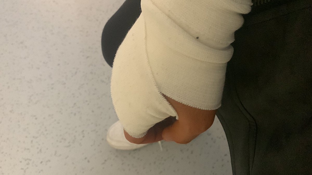 Drähte endlich gezogen ✅ 2te op hinter mir ✅