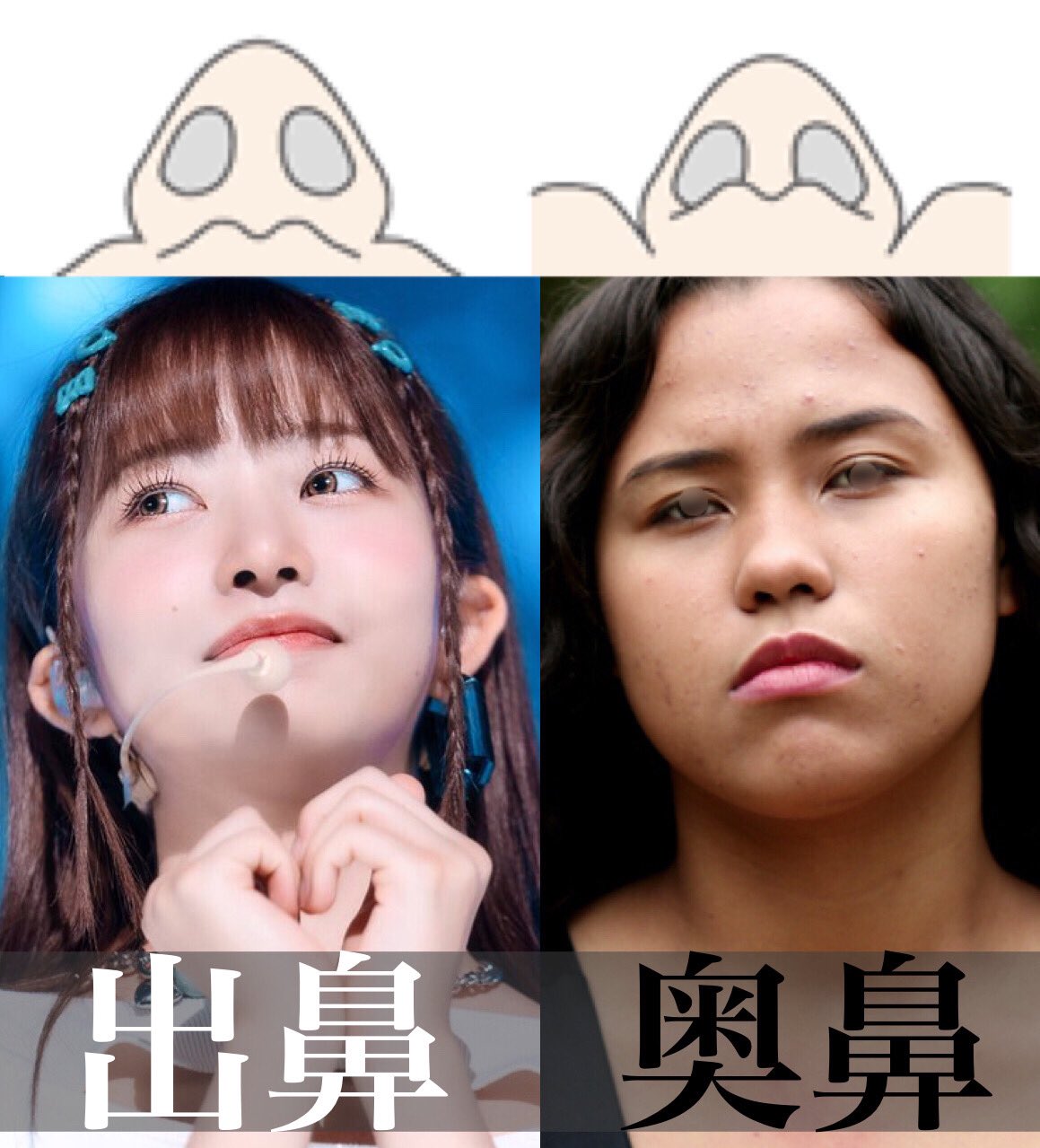 鼻整形の医師選び🏥鼻翼縮小、人中短縮、鼻尖形成、小鼻縮小、鼻フル、二重切開、鼻中隔延長、目頭切開 on Twitter