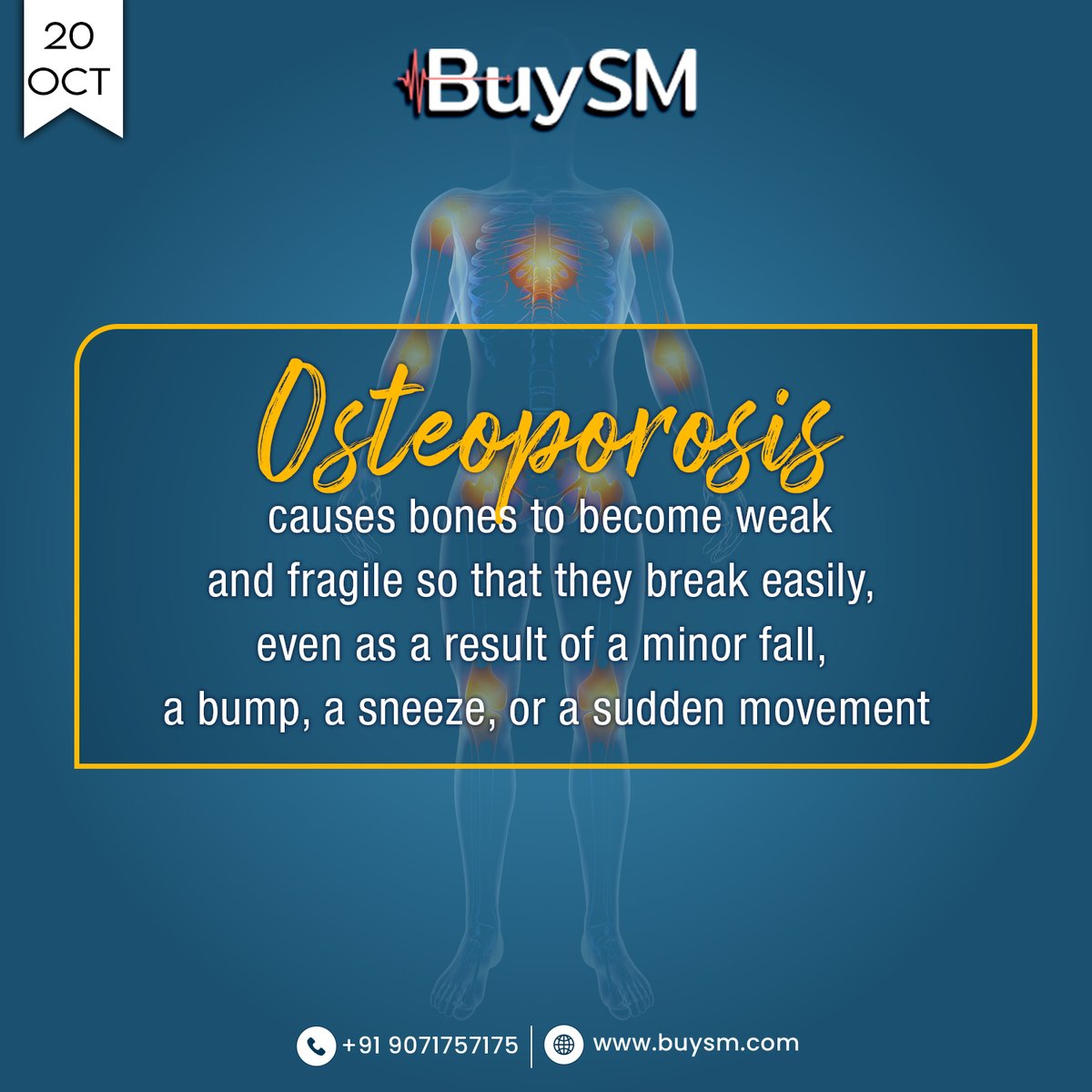buysmofficials's tweet photo. About 10 million Indians, both men, and women, experience osteoporotic fractures every year.
Bone health is vital throughout one's life. People should not, however, take their ability to have strong bones for granted.
#buysm #WorldOsteoporosisDay #specialitymedicines  #pharma https://t.co/im5mSy5VOS