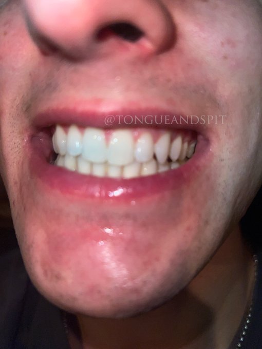 2 pic. Louis Hillcrest showing his mouth. https://t.co/HMB02ayu6j #malemouth #mouthfetish https://t.