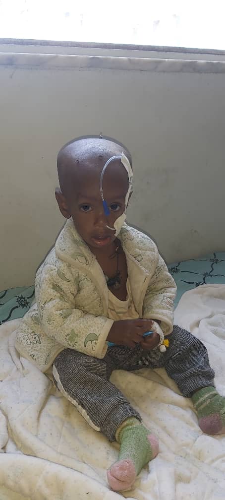 ayder_hospital's tweet photo. Efrem, 1 yr infant admitted with SAM to #AyderHospital desperately looks for food.
Civilians who have no agency in the war including children are paying the cost of the #TigraySiege.
BBC has broadcasted the horrors of the Siege.
https://t.co/w4JYPaNgmx https://t.co/0g57m06OZx