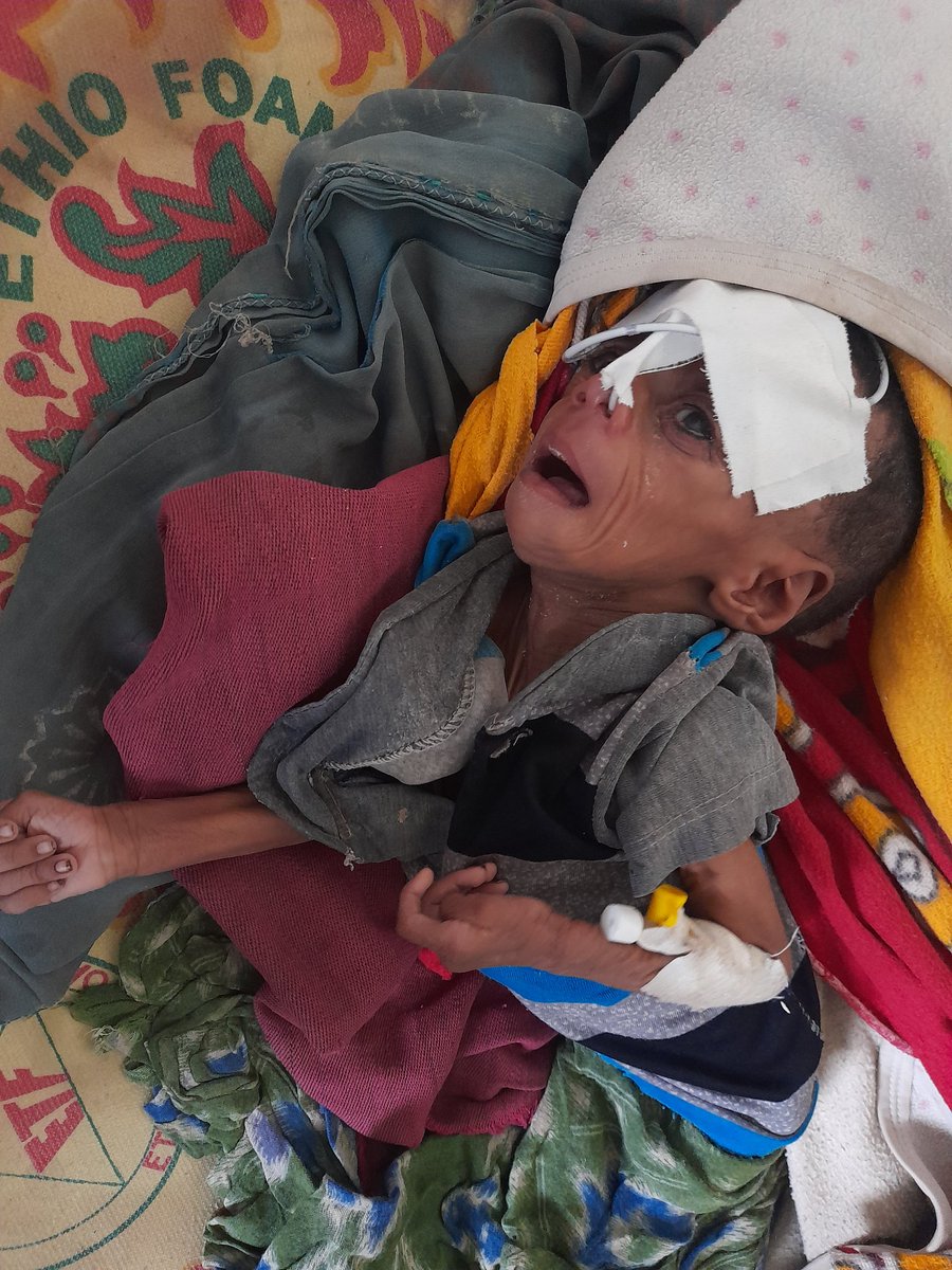FAmdeslasie's tweet photo. Allow international journalists in to Tigray. I dare anybody who denies that children are dying from deliberate starvation from barbaric siege. https://t.co/FG6As2fPdP