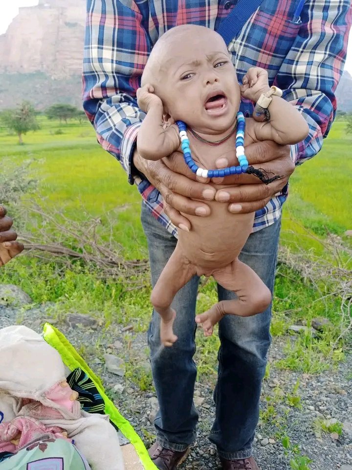 StayPostiveever's tweet photo. Allow international journalists in to tigray. I dare anyone who says that children are dying because of deliberate starvation due to the barbaric siege.@RepHuffman @UNHumanRights @JosepBorrellF @BradSherman @SecBlinken @antonioguterres @USAmbUN @UN @WHO @DrTedros https://t.co/jBml90rysF