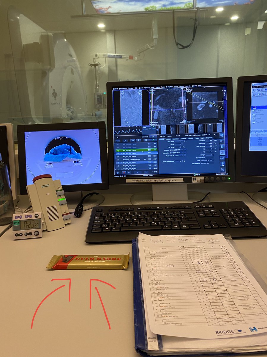 Important to celebrate 🥳 Today we complete study day 50 (of 80) in the MRI basement at <a href="/Rigshospitalet/">Rigshospitalet</a> studying GIP+GLP-2 in gut blood flow #alwayschocolate @UCPH_BRIDGE <a href="/GPCR_ucph/">GPCR_ucph</a> @BiomedUCPH
