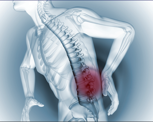 ASBMR's tweet photo. Vertebral (spine) #fractures can lead to back pain, height loss, deformity, immobility, increased number of bed days, and reduced pulmonary function #ASBMR #WorldOsteoporosisDay @iofbonehealth 

https://t.co/poeN2kdmWv https://t.co/Aim4Erwwin
