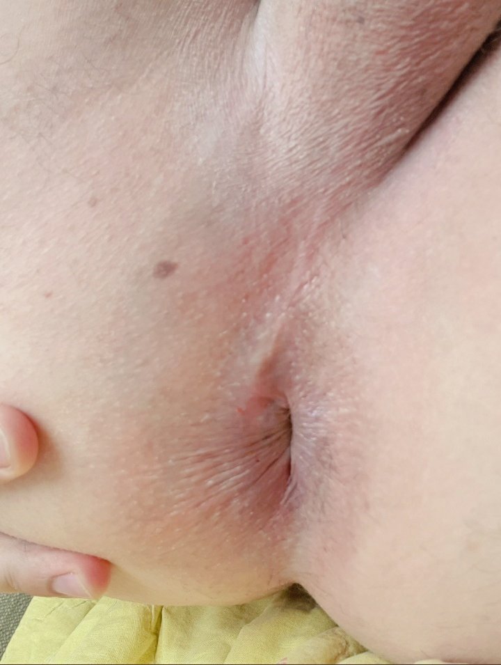siciliabig's tweet photo. Sua maestà, la figa anale da spaccare.
Her majesty anal pussy to crack. 💦💦💦💦🤪🤪🤪🤪
#sex #porn #muscle #MuscleDaddyBttm #musclepig #bsx #porn #cum #publicexhibtionsm #publictoilet #20ottobre #malamjumat #femdom #pussy #figa #BottomCums #bottom4top #Passive https://t.co/dFn4CHcojg