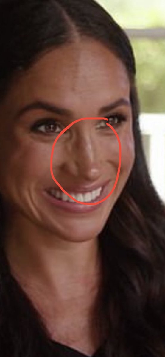 NaomiSky15 on Twitter "Her nose is collapsing! 😬🫣 oh my god. What is