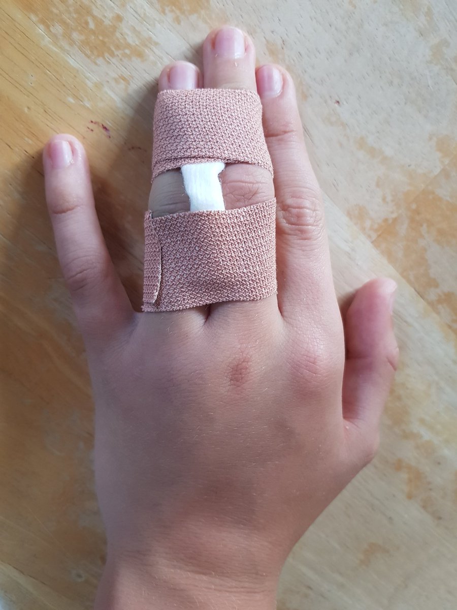 Marika Stevens (@meekyjb) on Twitter photo Thank you <a href="/ESHTNHS/">East Sussex Healthcare NHS Trust</a> for fantastic treatment in A&E. Triage, x-ray and fracture clinic booked within 90mins 👏👏👏👏👏👏 Thank you <a href="/ESHTNHS/">East Sussex Healthcare NHS Trust</a> for fantastic treatment in A&E. Triage, x-ray and fracture clinic booked within 90mins 👏👏👏👏👏👏