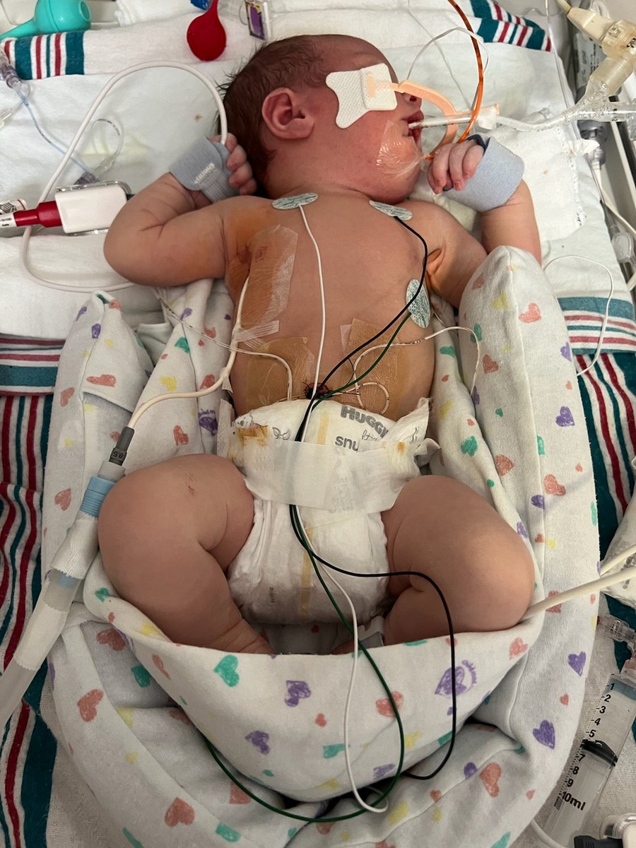 smirksrule's tweet photo. Prayers needed for my daughter and her little family. New baby boy born with #NeonatalPneumothorax and needs lots of prayers. #PrayersForKeeanJace https://t.co/Tq9oE65xaP