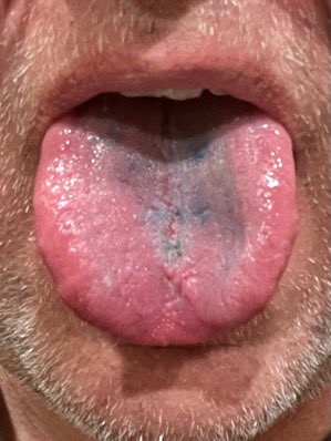 Bagrly's tweet image. H*ly f**king sh*t! I just licked the thing a little bit and my tongue 👅 and mouth 👄 are ON. FIRE 🔥!! Big fail by me at the #ONECHIPCHALLENGE from @PAQUICHIPS!!! #paquichips #onechipchallenge2022