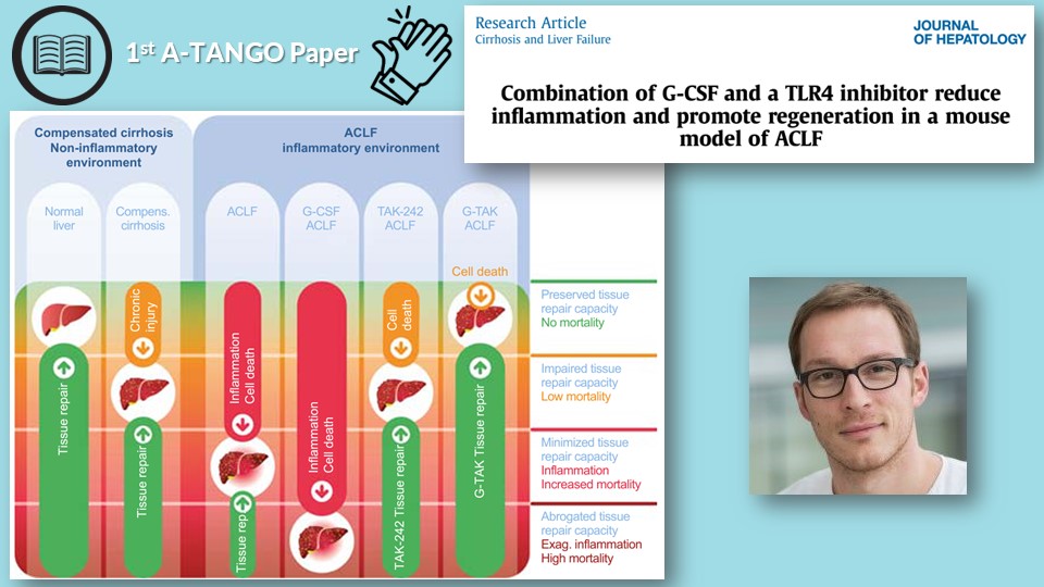 journal-of-hepatology.eu/article/S0168-… Our @JHepatology article by @CorneliusEngel7 et al. highlights the scientific basis of A-TANGO & the therapeutic potential of the G-TAK #therapy for #ACLF. Recruitment starts in 2023! @ef_clif @RajivJalan1 @EASLnews @ThomasBerg24 #LiverTwitter @EuropeLiver