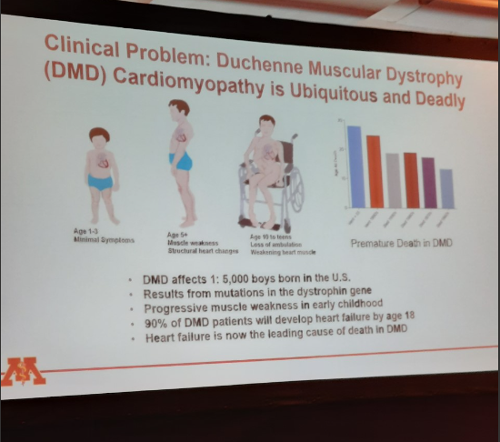 Duchenne muscular dystrophy (DMD) affects 1 in 5000 boys in the U.S. @ForumKamdar uses patient-derived cells to better understand DMD cardiomyopathy with a goal of developing more effective treatments #CSDAandPSF